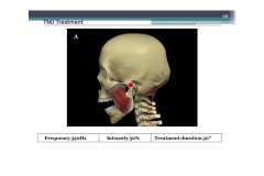 Slide11