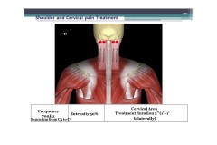 Slide14