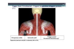Slide16