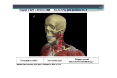 Slide20
