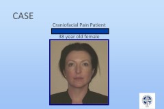 Slide12-1
