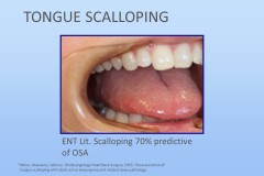 Slide30