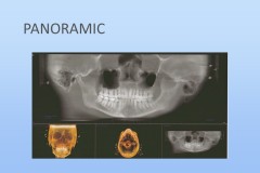 Slide32