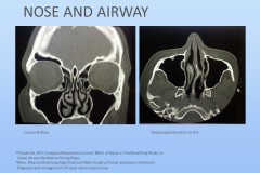 Slide34