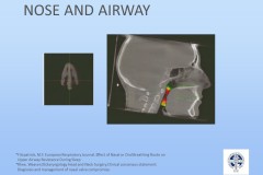 Slide35