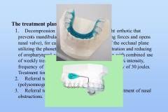 Slide39