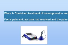 Slide40