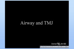 Slide49