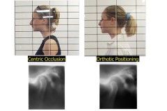 Slide56