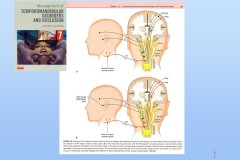 Slide62