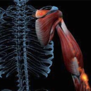 Webinar: MLS and Regenerative Medicine:  Applications for the Spine