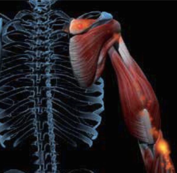 Webinar: MLS and Regenerative Medicine:  Applications for the Spine