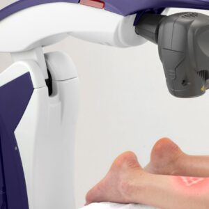 Webinar: How to Use MLS® Laser for Challenging Lower Leg Pain webinar