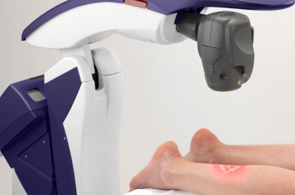 Webinar: How to Use MLS® Laser for Challenging Lower Leg Pain webinar
