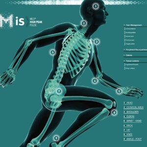 Webinar: MiS High Peak Laser Educational Webinar