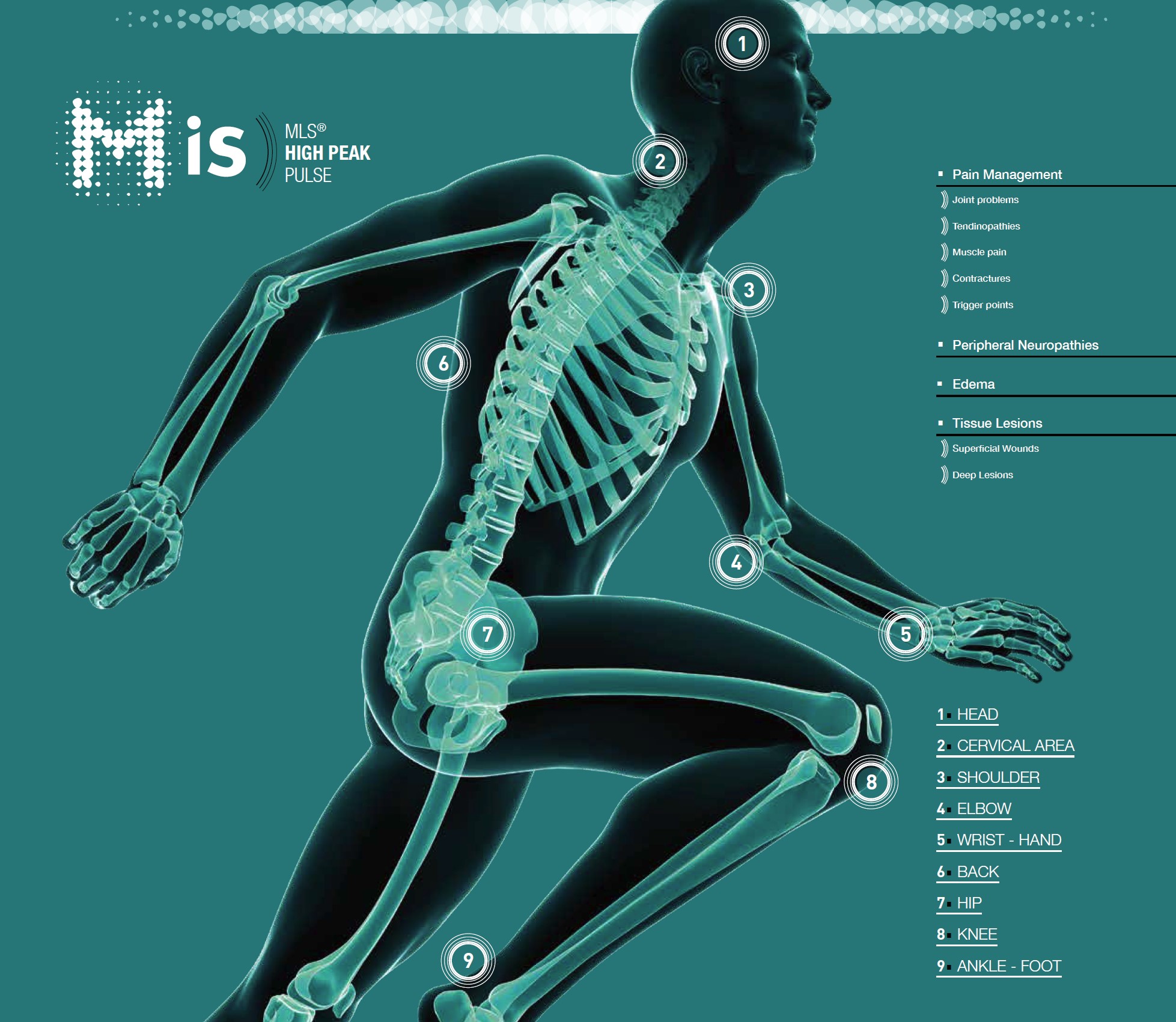 Webinar: MiS High Peak Laser Educational Webinar